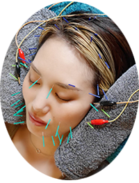 極電気美容鍼イメージ